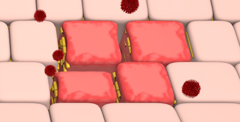 Geschädigte Darmbarriere