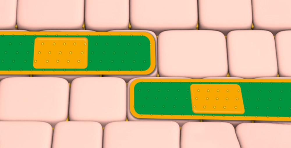 Kijimea Pflaster-Effekt PRO