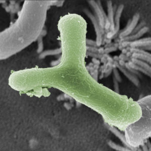 Bifidobakterienstamm B. bifidum HI-MIMBb75